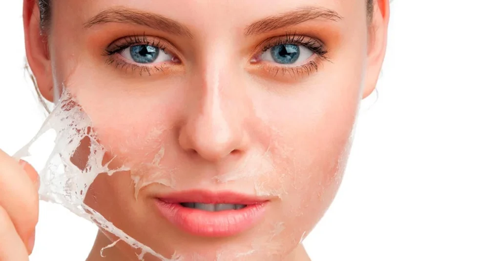 Chemical Peels in Rajahmundry