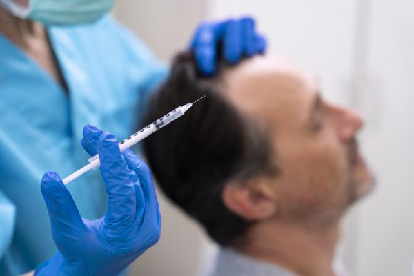 man-getting-hair-loss-treatment